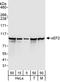 Eukaryotic Translation Elongation Factor 2 antibody, A301-688A, Bethyl Labs, Western Blot image 