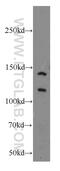 Nuclear Receptor Corepressor 1 antibody, 20018-1-AP, Proteintech Group, Western Blot image 