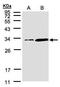 Phosphatidylinositol Transfer Protein Alpha antibody, TA308387, Origene, Western Blot image 