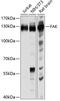 Protein Tyrosine Kinase 2 antibody, 13-008, ProSci, Western Blot image 