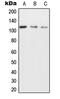 Ubiquitin Associated Protein 2 Like antibody, LS-C353210, Lifespan Biosciences, Western Blot image 