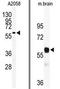 Pyruvate Kinase M1/2 antibody, AP13827PU-N, Origene, Western Blot image 