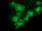LIM And Cysteine Rich Domains 1 antibody, TA502790, Origene, Immunofluorescence image 