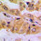 SMAD2 antibody, GTX54987, GeneTex, Immunohistochemistry paraffin image 