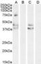 Angiotensin II type-1 receptor antibody, NB100-57073, Novus Biologicals, Western Blot image 