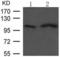 Fibroblast Growth Factor Receptor 4 antibody, TA321424, Origene, Western Blot image 