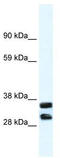 Annexin A13 antibody, TA341658, Origene, Western Blot image 
