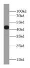 Alpha-Methylacyl-CoA Racemase antibody, FNab06082, FineTest, Western Blot image 