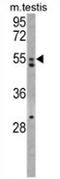 Anti-Mullerian Hormone Receptor Type 2 antibody, AP13725PU-N, Origene, Western Blot image 