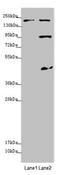 Myosin VB antibody, LS-C676110, Lifespan Biosciences, Western Blot image 