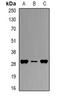 Major Histocompatibility Complex, Class II, DP Beta 1 antibody, LS-C482279, Lifespan Biosciences, Western Blot image 