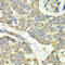 Elongation factor Tu, mitochondrial antibody, 22-209, ProSci, Immunoprecipitation image 