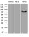 MYCN Proto-Oncogene, BHLH Transcription Factor antibody, LS-C792041, Lifespan Biosciences, Western Blot image 