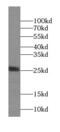 N-alpha-acetyltransferase 11, NatA catalytic subunit antibody, FNab00527, FineTest, Western Blot image 