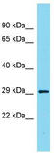 Rho-Type GTPase-Activating Protein 11B                     antibody, TA334130, Origene, Western Blot image 