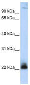 Integrin Subunit Beta 3 Binding Protein antibody, TA334507, Origene, Western Blot image 