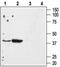 Angiotensin II type-1 receptor antibody, PA5-77280, Invitrogen Antibodies, Western Blot image 