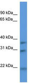 NECAP Endocytosis Associated 1 antibody, TA333654, Origene, Western Blot image 