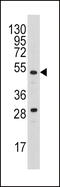 Urokinase antibody, 63-439, ProSci, Western Blot image 