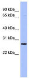 Homeobox A6 antibody, TA345375, Origene, Western Blot image 