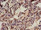 SMAP antibody, LS-C671601, Lifespan Biosciences, Immunohistochemistry paraffin image 