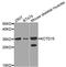 BTB/POZ domain-containing protein KCTD15 antibody, STJ110555, St John