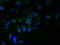 Retention In Endoplasmic Reticulum Sorting Receptor 1 antibody, A60578-100, Epigentek, Immunofluorescence image 