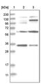 Oxysterol Binding Protein 2 antibody, PA5-54432, Invitrogen Antibodies, Western Blot image 