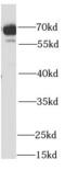 Succinate dehydrogenase [ubiquinone] flavoprotein subunit, mitochondrial antibody, FNab07669, FineTest, Western Blot image 