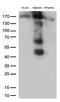 CD163 antibody, M00812-3, Boster Biological Technology, Western Blot image 
