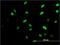 ISL LIM Homeobox 1 antibody, H00003670-M05, Novus Biologicals, Immunocytochemistry image 