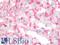 HSPG antibody, LS-B10057, Lifespan Biosciences, Immunohistochemistry paraffin image 