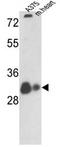 hVDAC1 antibody, AP17825PU-N, Origene, Western Blot image 