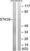 Serine/Threonine Kinase 39 antibody, TA326086, Origene, Western Blot image 