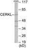 Ceramide Kinase Like antibody, EKC1845, Boster Biological Technology, Western Blot image 