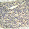 LIM Domain Kinase 1 antibody, AP0387, ABclonal Technology, Immunohistochemistry paraffin image 
