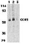 C-C Motif Chemokine Receptor 3 antibody, orb74311, Biorbyt, Western Blot image 