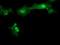 Metabolism Of Cobalamin Associated C antibody, NBP2-45884, Novus Biologicals, Immunofluorescence image 