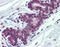 Poly(RC) Binding Protein 1 antibody, ARP40631_P050, Aviva Systems Biology, Immunohistochemistry paraffin image 