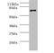 Helicobacter pylori Urease subunit beta  antibody, orb240675, Biorbyt, Western Blot image 
