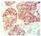 Keratin 5 antibody, BM6002P, Origene, Immunohistochemistry frozen image 