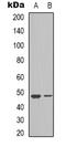 Vascular Endothelial Growth Factor C antibody, orb339144, Biorbyt, Western Blot image 