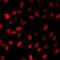 LIM Homeobox 8 antibody, LS-C668950, Lifespan Biosciences, Immunofluorescence image 