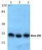 Homeobox protein Hox-D8 antibody, A10857-1, Boster Biological Technology, Western Blot image 