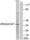 Olfactory Receptor Family 2 Subfamily A Member 7 antibody, GTX87198, GeneTex, Western Blot image 