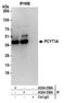 Choline-phosphate cytidylyltransferase A antibody, A304-559A, Bethyl Labs, Immunoprecipitation image 