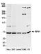 Dolichyl-diphosphooligosaccharide--protein glycosyltransferase subunit 1 antibody, A305-027A, Bethyl Labs, Western Blot image 