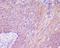 Desmoglein 1 antibody, M02655-1, Boster Biological Technology, Immunohistochemistry frozen image 
