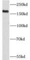 Lysine Demethylase 5C antibody, FNab04513, FineTest, Western Blot image 