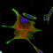 Bone Morphogenetic Protein Receptor Type 2 antibody, LS-C812516, Lifespan Biosciences, Immunohistochemistry paraffin image 